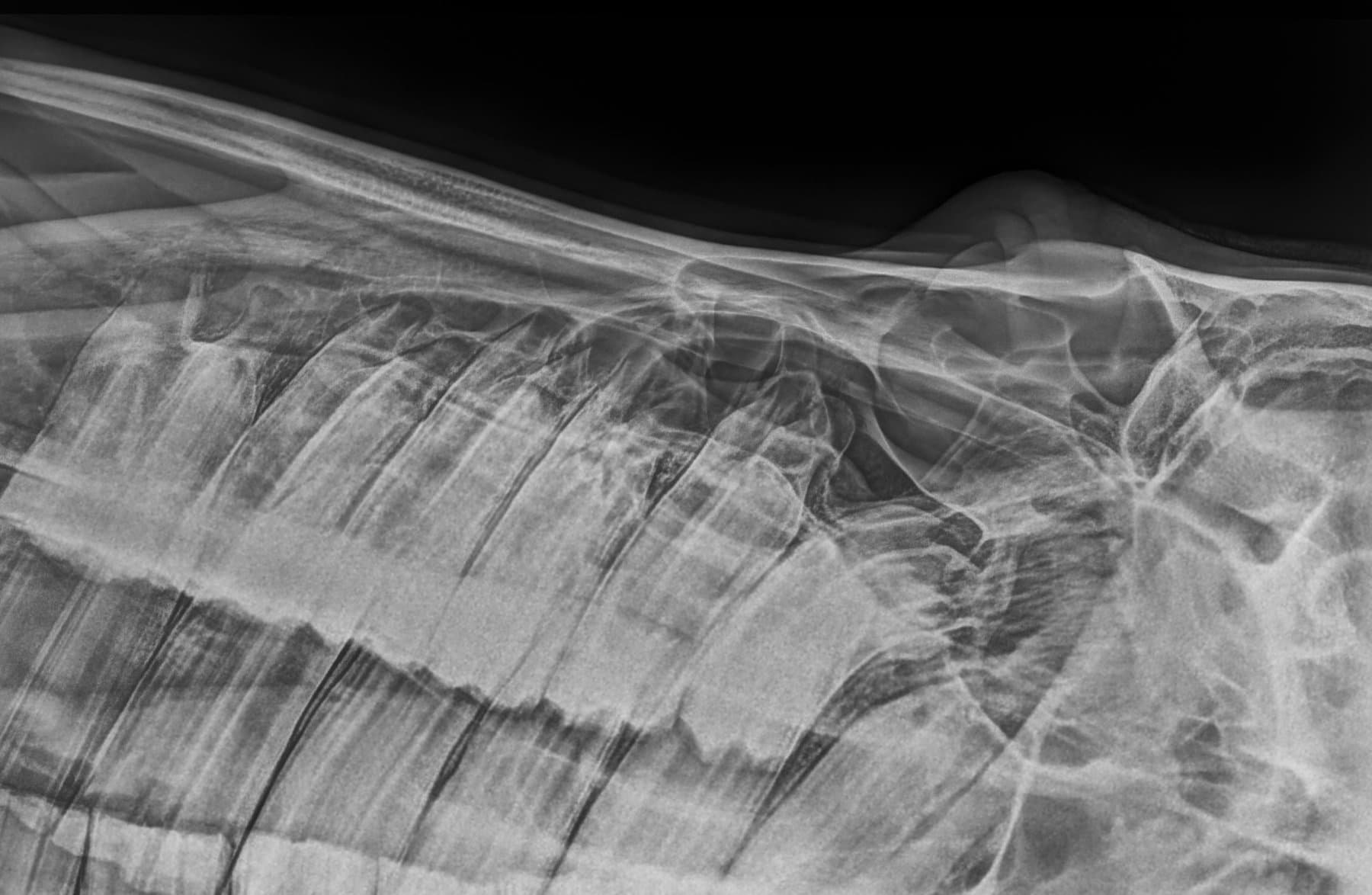 Digital radiograph of a horse's thorax