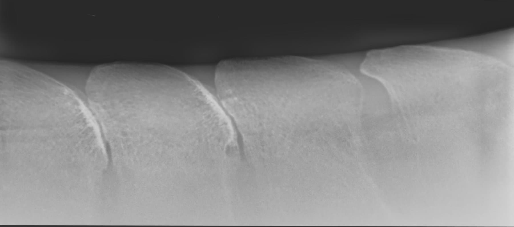 Digital radiograph of a horse's back