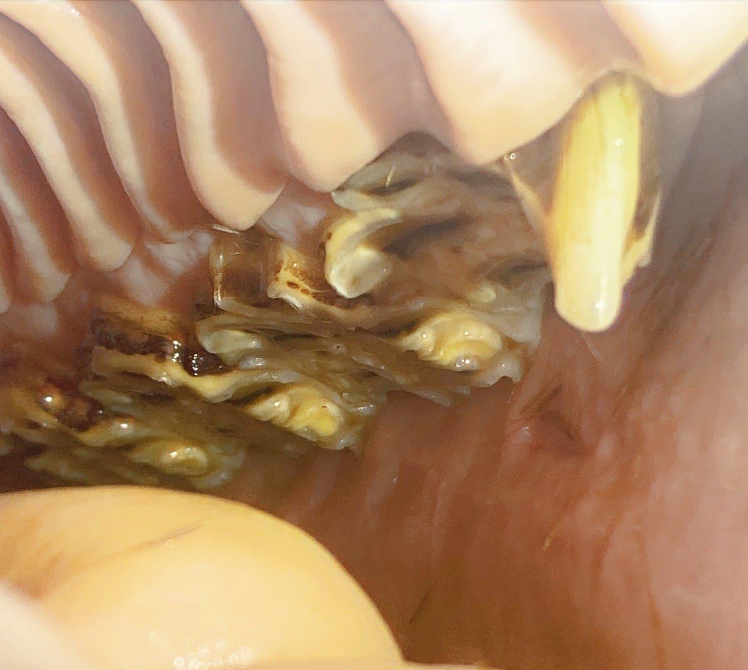 Endoscope view of the cheek teeth